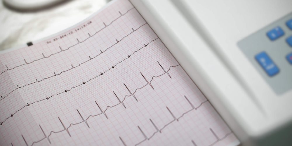 Afib Pic (1)