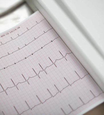 Atrial Fibrillation: An Overview and Update