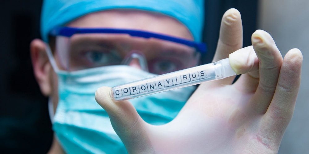 A scientist holds in his hand a test tube with the virus coronavirus.