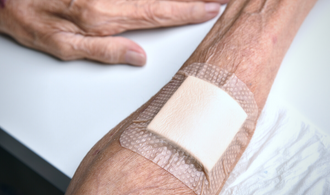 Skin Tear Treatment for Elderly Patients