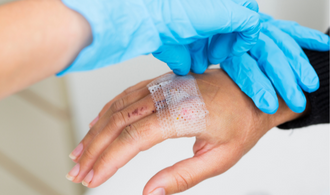 The Basics of Wound Healing